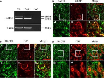 Expression of BACE1 in the Rat Carotid Body